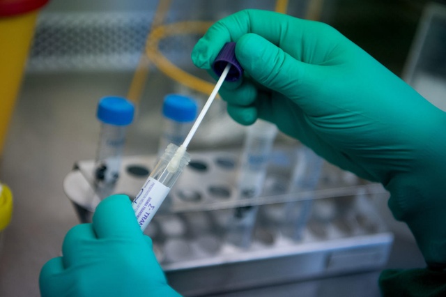 Convoca COPOCYT a empresas a producir hisopos para prueba covid-19