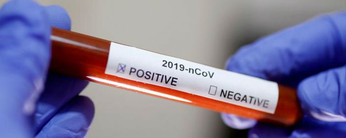 SS cuenta con más de 16 mil pruebas para confirmación diagnóstica de covid-19 en el estado.